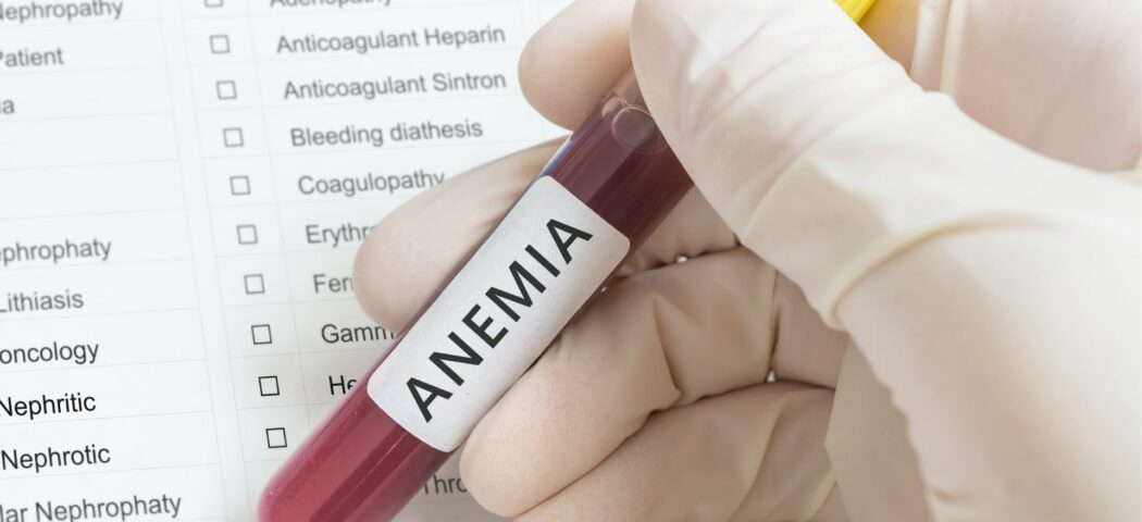 Tipi di anemia e come riconoscerli